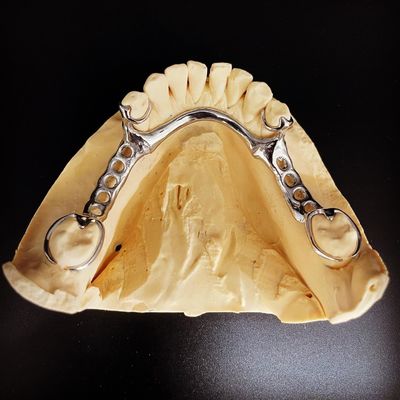 kopen Fast and Cast Frame Co-Cr Metal Partial Denture Framework voor tandartsen online vervaardiging