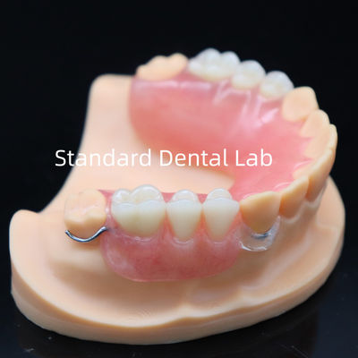 kopen Hoge esthetiek acryl partiële prothese met heldere sluiting en acryl tanden China Dental Lab online vervaardiging