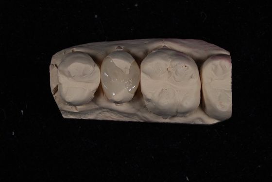 kopen Kracht Emax keramische fineerkronen met uitstekende vlekbestendigheid / biocompatibiliteit online vervaardiging