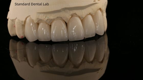 kopen Volledige contour Zirconia kroon en hoge esthetiek natuurlijke gebit brug 5 jaar garantie online vervaardiging