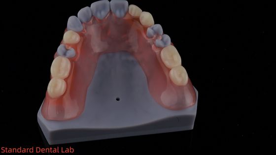 kopen 3D-printmodel Hoge esthetiek tandheelkundig TCS Valplast Flexibel gedeeltelijk tandheelkundig tandheelkundig laboratorium online vervaardiging