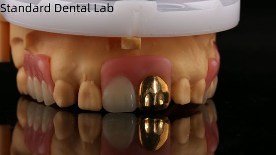 kopen Volledige acrylprothesen met gele gouden tanden/tandheelkundige tijdelijke acrylprothese Ivoclar Professional FDA goedgekeurd online vervaardiging