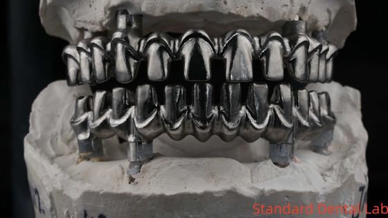 kopen Tandheelkundige Hybird Malo Implant Bridge Professional Perfect Fit FDA gecertificeerd online vervaardiging