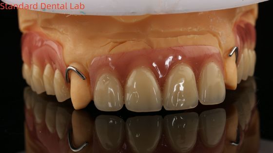 kopen Warmtebehandeld Ivoclar Partiële Acryl Prothese Tandheelkundig Lab Hoge nauwkeurigheid met 3D-printmodel online vervaardiging