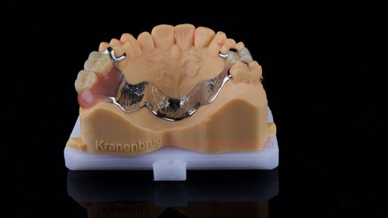 kopen Gedeeltelijke Cobalt Chroom Prothesen Ivoclar Scheftner Comfortabel metalen frame geleverd in slechts 3 dagen online vervaardiging