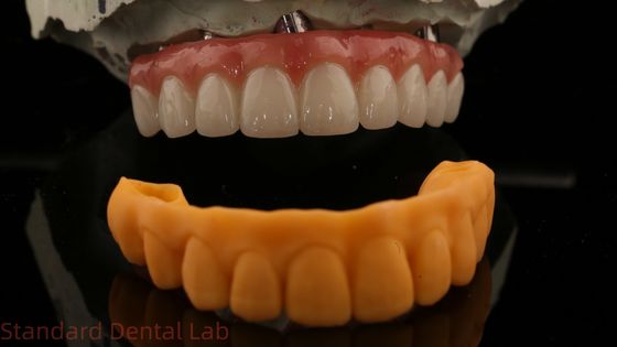 kopen 5 jaar garantie tandheelkundige implantaat kroon PMMA brug over Multi Unit Abutments Customized Vita Shade online vervaardiging