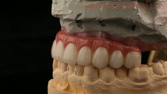 kopen Hybride titanium schroef vastgehouden tandheelkundige implantaat kroon alle op 4 tandheelkundige implantaat Zirconia brug online vervaardiging