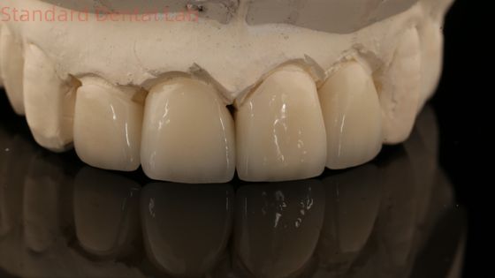 kopen Sterke gelaagde Zirconia kroon en brug In goede esthetiek Zirconia gelaagde China tandheelkundige laboratorium online vervaardiging