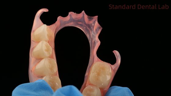 kopen Tandheelkundige TCS Valplast Flexible Partial Protheses Tandheelkundig Lab 3D Print Model Hoge esthetiek online vervaardiging