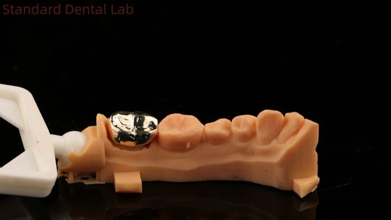 kopen Hoog Nobel Geel Goud Kroon Tand Professionele Ni Be Gratis ISO En FDA goedgekeurd China tandheelkundige lab online vervaardiging