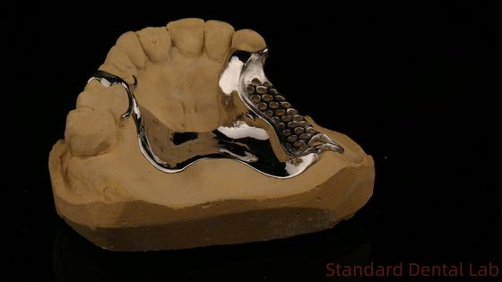 kopen Hoge sterkte 3D geprint gegoten frame COCR gedeeltelijke gebit Chroom Cobalt gegoten metaal frame online vervaardiging