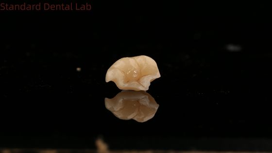 kopen Kracht Emax Keramische kroon tandheelkundige onlay met uitstekende vlekbestendigheid China Dental Lab online vervaardiging