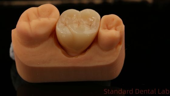 kopen Volle Zirconia kroon, China tandheelkundig lab snelle levering online vervaardiging