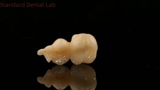 kopen Tandheelkundige Digitale Volledige Zirconia Kroon Met 3D Print Model SDL Dental Lab Zirconia Onlay online vervaardiging