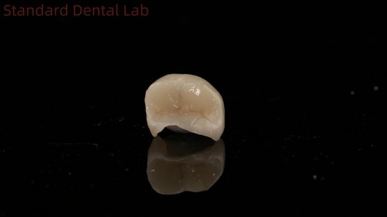 kopen Translucide tandheelkundige Zirconia kroon Inlay Onlay kroon voor het herstellen van de natuurlijke holte vorm online vervaardiging
