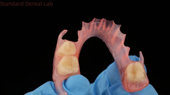 kopen 3D-print model tandheelkundig TCS Valplast Flexible partiële prothesen Roze / donkere kleur tandheelkundig laboratoriumproduct online vervaardiging
