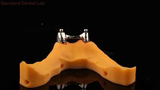 kopen Ivoclar Digitale Tandheelkundige Implantaten Bar Prothese met Aanhangsels, Volledige Acryl Titanium Implantaten Ondersteunde Protheses online vervaardiging