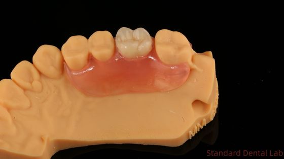 kopen Tandheelkundige TCS Valplast Flexible Partial Protheses Nesbit Valplast Finish China Dental Lab Valplast Clamp online vervaardiging