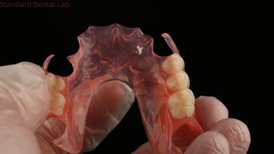 kopen Ace Teeth Roze/donker TCS Valplast Flexible partiële tandheelkundige prothesen voor een hoge esthetiek online vervaardiging