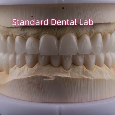 Tandheelkundig laboratorium Volle boog Zirconia Porseleinen Kronen PFZ Kroon ISO FDA CE