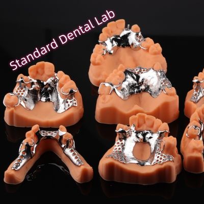 CAD CAM Afneembare gedeeltelijke tandheelkunde Metalen frame 3Shape Exocad tandheelkundige ontwerp