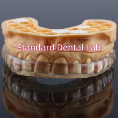 Professionele Custom Anti Snorking Tandheelkundige Guard Opgewaardeerde Night Mouthguard Voor Tanden Knarsen