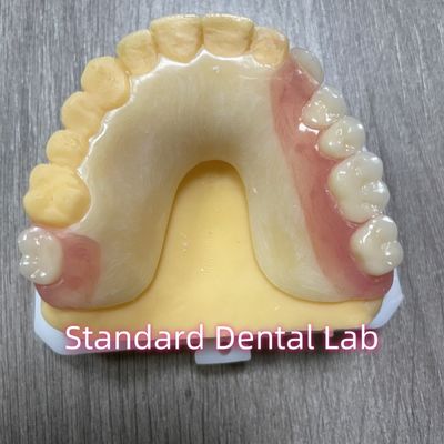 OEM Afneembare gegoten tandschaduw Acryl gedeeltelijke tandheelkunde met klemmen