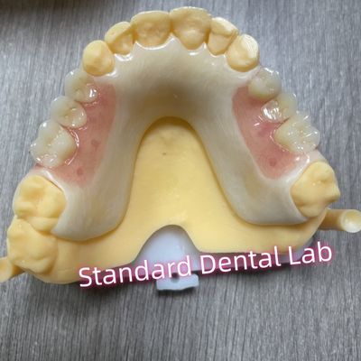 Boven tandschaduw Acetaal frame Acryl sluiters Afneembare gedeeltelijke gebit