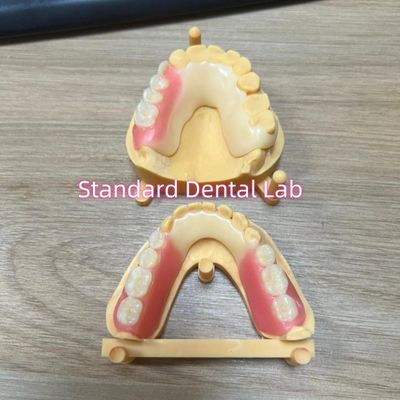 Esthetische tanden schaduw Acetaal frame Tanden gekleurde klauwen Ivoclar Set