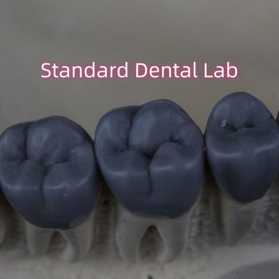 Professionele Digitale Tandheelkundige Lab Wax Up 3shape FDA goedgekeurd