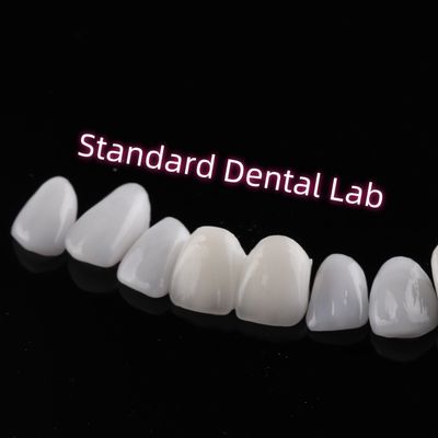 Abrasiebestendig Emax Zirconia Laminate Veneers Incisie Translucentie