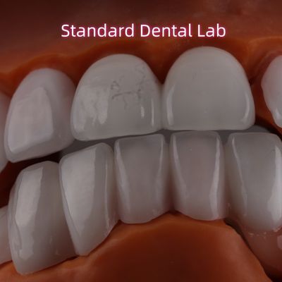 Lithium Dicilicate laag Ivoclar Emax Zirconia Laminate Veneers Translucent OEM ODM