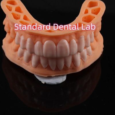 OEM ODM Pop On Veneers Op maat gemaakte veneers Snap On Smile