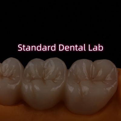 Hoogtranslucent PFZ gelaagd Zirconia brug Porselein keramische achterkant