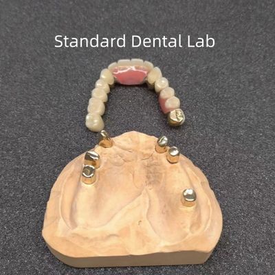 CAD CAM Tand gedeeltelijke tandheelkundige bevestiging tandarts Accuraat