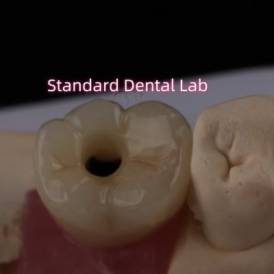 Achterste Implantatie Crown Bruxier Solid Zirconia Schroef