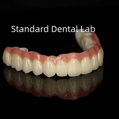 Esthetisch monolithisch porselein Zirconia kroon Volledig boogtranslucentie