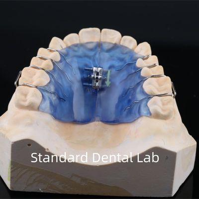 Schroefboog tandheelkundige tanden gehemelte expander verwijderbare ortho schroef expander
