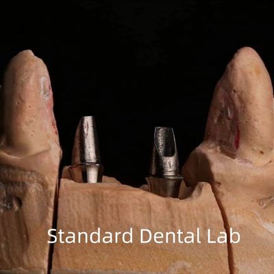 Tandheelkundig porselein Zirconia Implantat Kroon Professionele hoge esthetiek