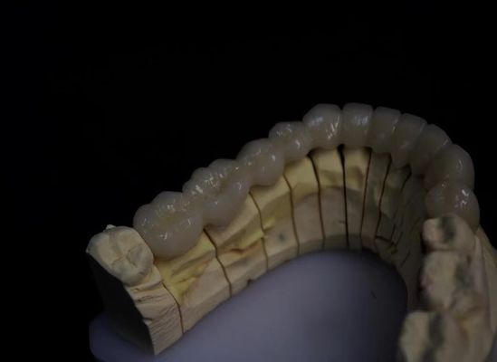 Geplatte porselein gesmolten zirconia