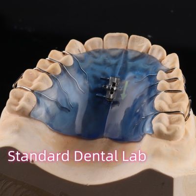 Verwijderbare gehemeltevergrotingsapparaat Orthodontie Professionele voor maxillaire mandibulaire