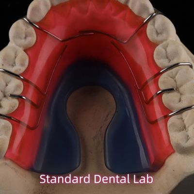 Verwijderbaar orthodontisch tandheelkundig apparaat Hawley Retainer