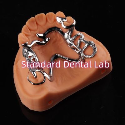 Cobalt Chrome Framework Ni Be Free verwijderbare tandheelkundige prothese China Dental Lab