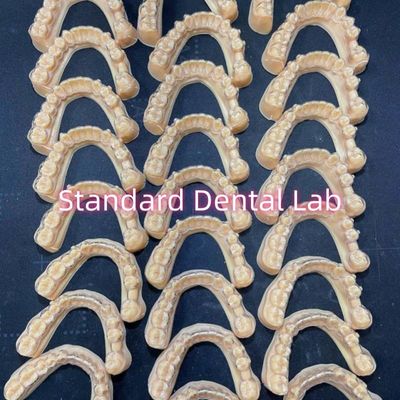 Professionele tandheelkundige orthodontische Invisalign Clear Retainers Behandelingsplan