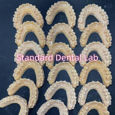 Professionele orthodontische Invisalign Clear Retainers
