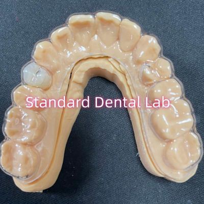Professionele orthodontische retainer Duidelijke Essix retainers met stabiele acrylhars tanden