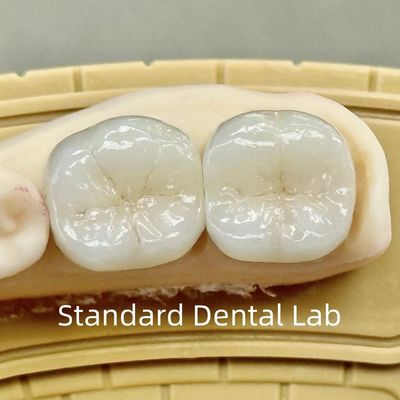 Tandheelkundige lab kronen doorzichtige full contour zirconia met superieure sterkte