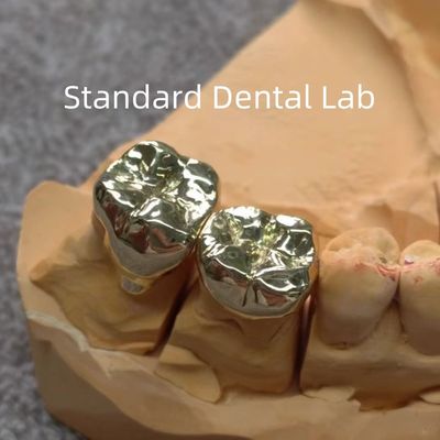 Hoge Nobel Geel Tandheelkundige Gouden Kronen Professionele Ni Be Free ISO goedgekeurd