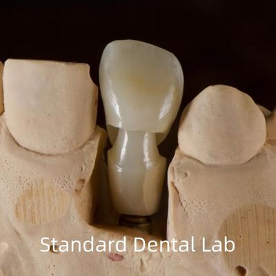 Tandheelkundig implantaat Tibase Zirconia Abutment Titanium nauwkeurigheid Op maat