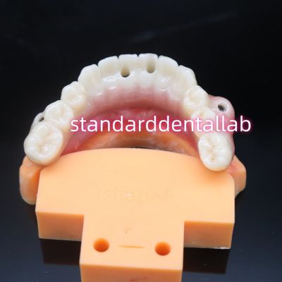 Biocompatibele tandkleurige Zirconia-implantatiebrug